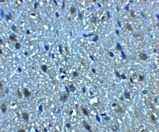 BTF Antibody