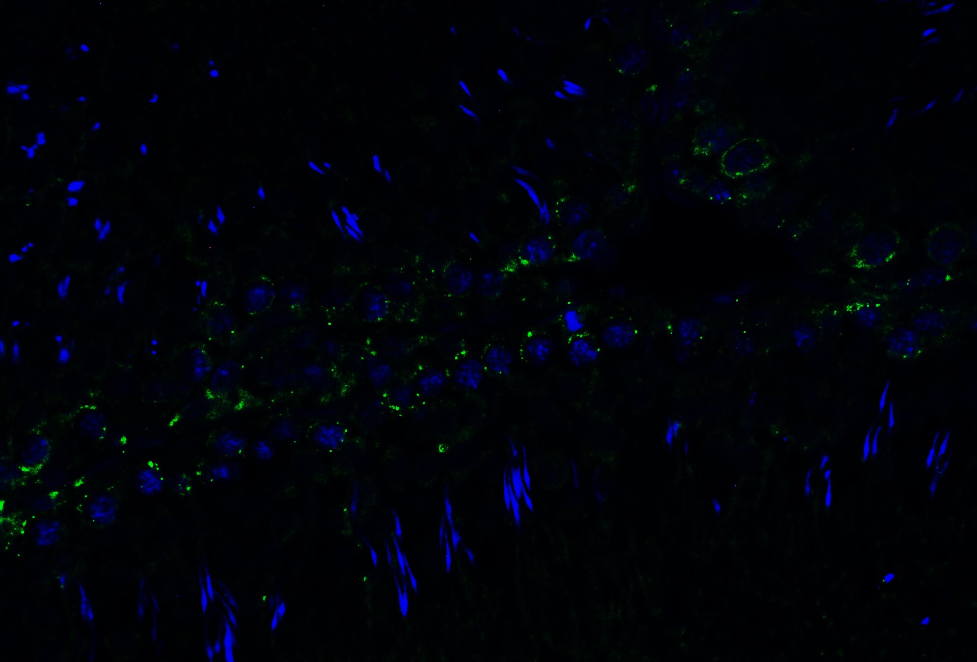 PGAM5 Antibody