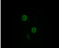 Apolipoprotein M/ApoM Antibody (8F12C6B8)