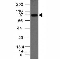UACA Antibody (UACA/1222)