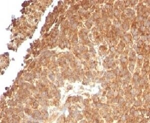 TOP1MT Antibody (TPIMT-1)