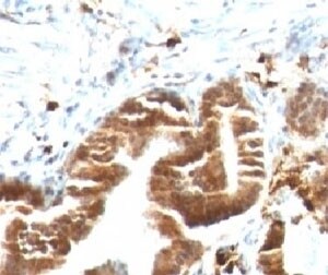 TOP1MT Antibody (TPIMT-1)