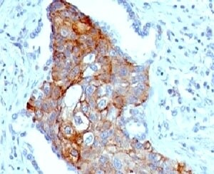 TRIM29 Antibody (TPMP29-1)
