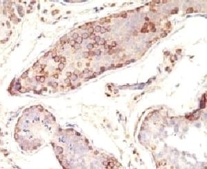 MAGEA1 Antibody (MAAZ2)