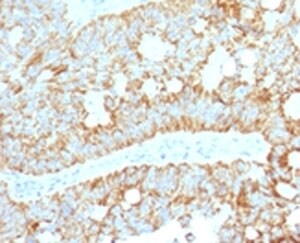 MAML2 Antibody (MMLP2-1)