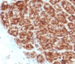 MAML2 Antibody (MMLP2-1)