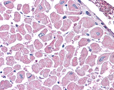 Kinesin 5B Antibody (KN-03)