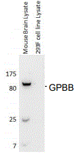 Glycogen Phosphorylase BB/GPBB Antibody (E9B10)