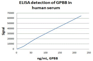 Glycogen Phosphorylase BB/GPBB Antibody (E9B10)