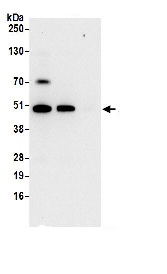 HADHB Antibody