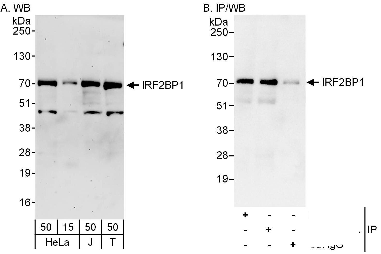 IRF2BP1 Antibody