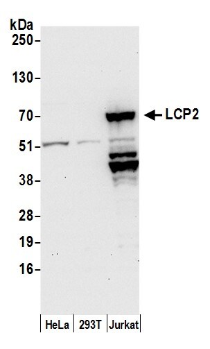 SLP-76/LCP2 Antibody