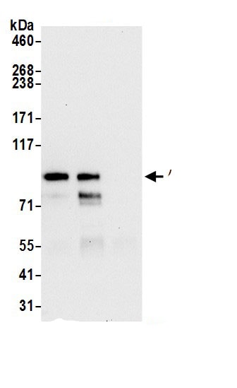 AMPD3 Antibody