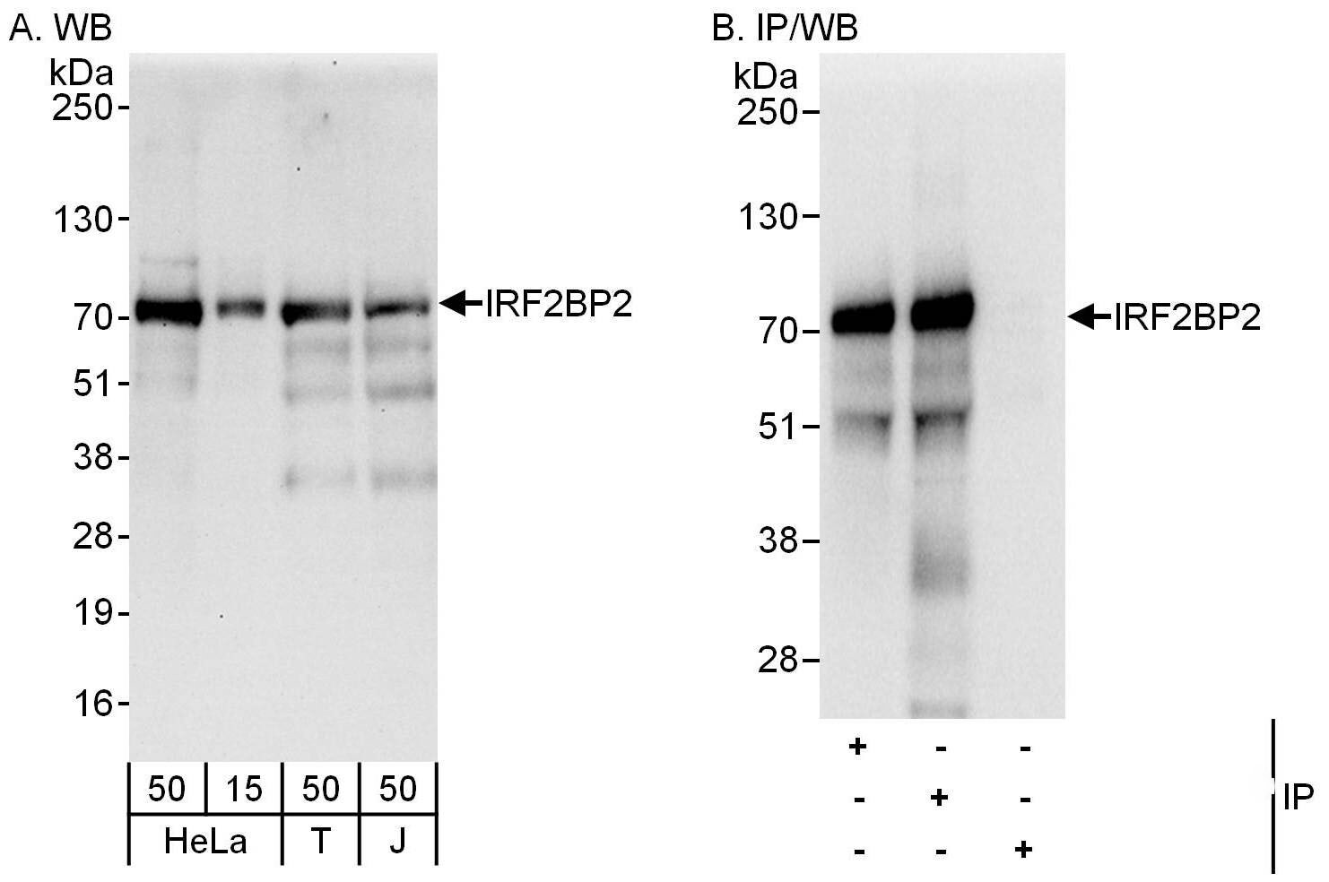 IRF2BP2 Antibody