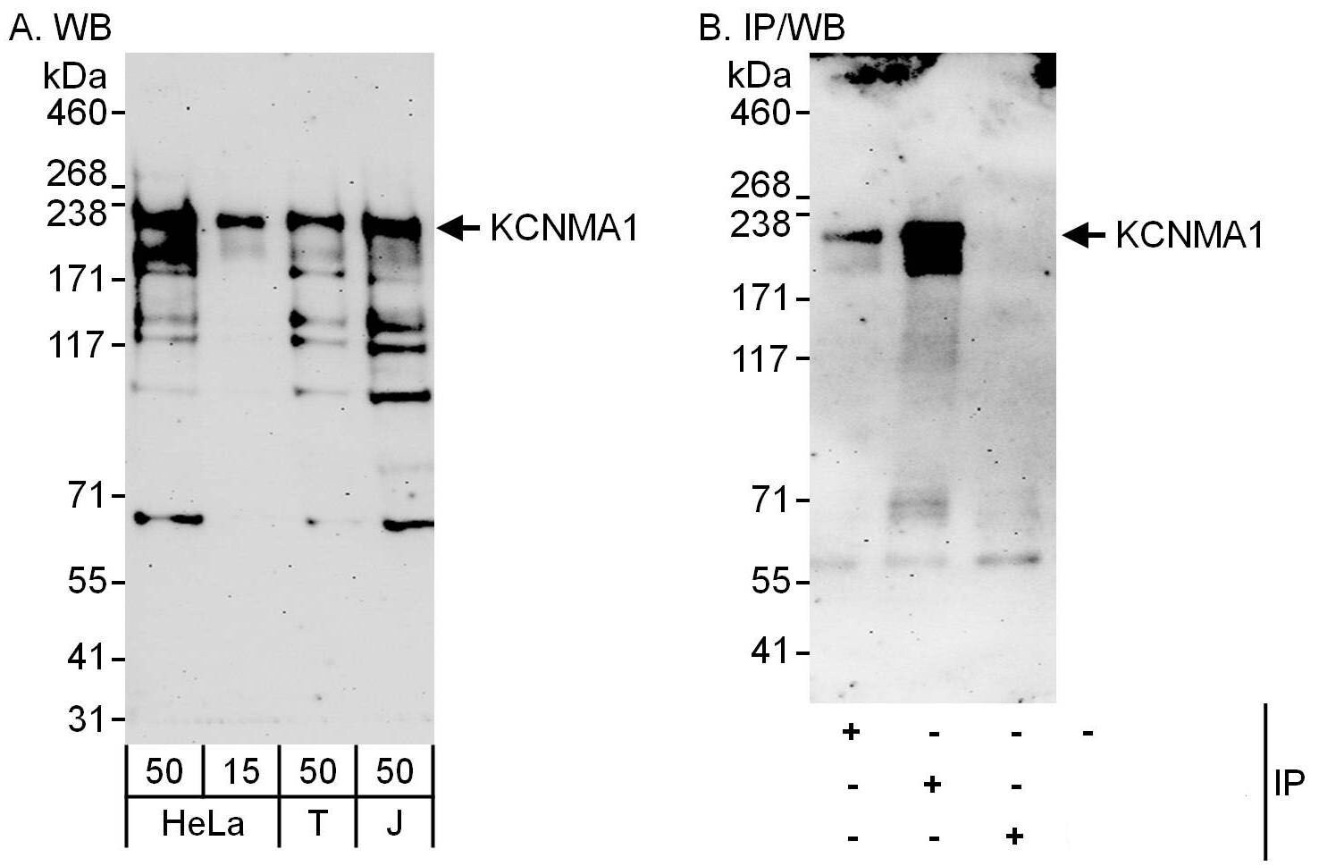 Maxi Potassium channel alpha Antibody
