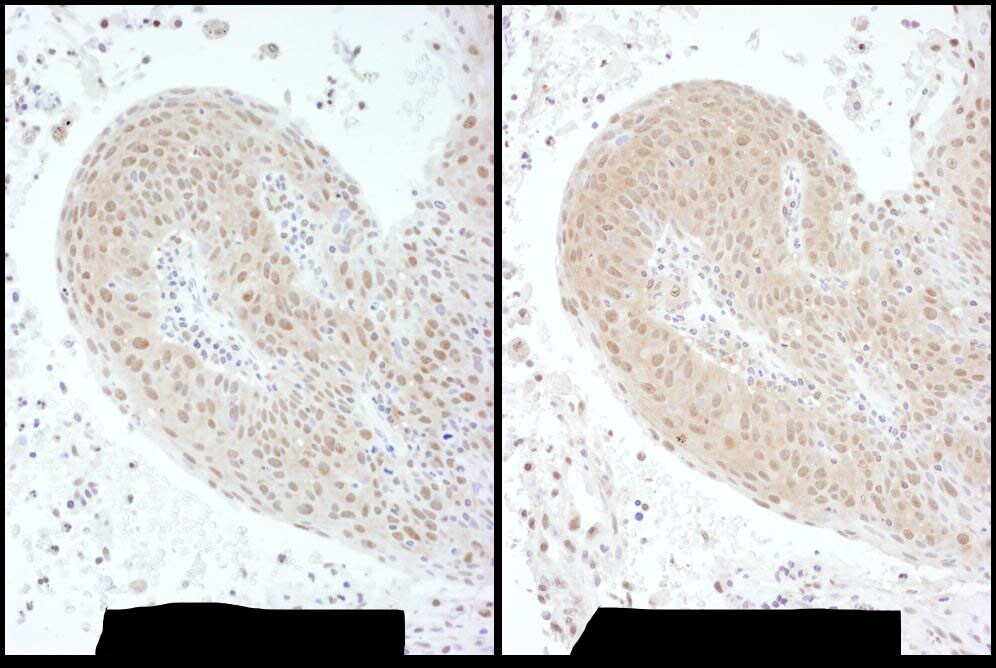 PSMC6 Antibody