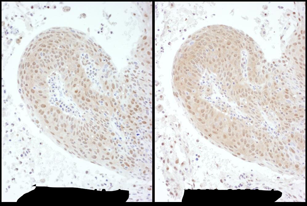 PSMC6 Antibody