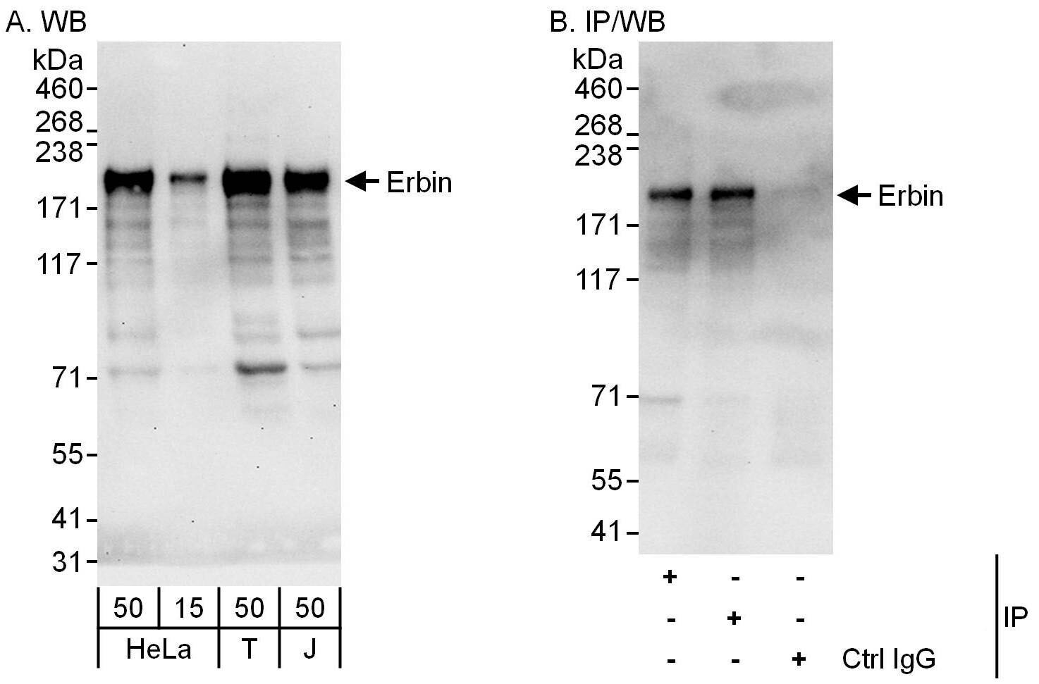 Erbin Antibody
