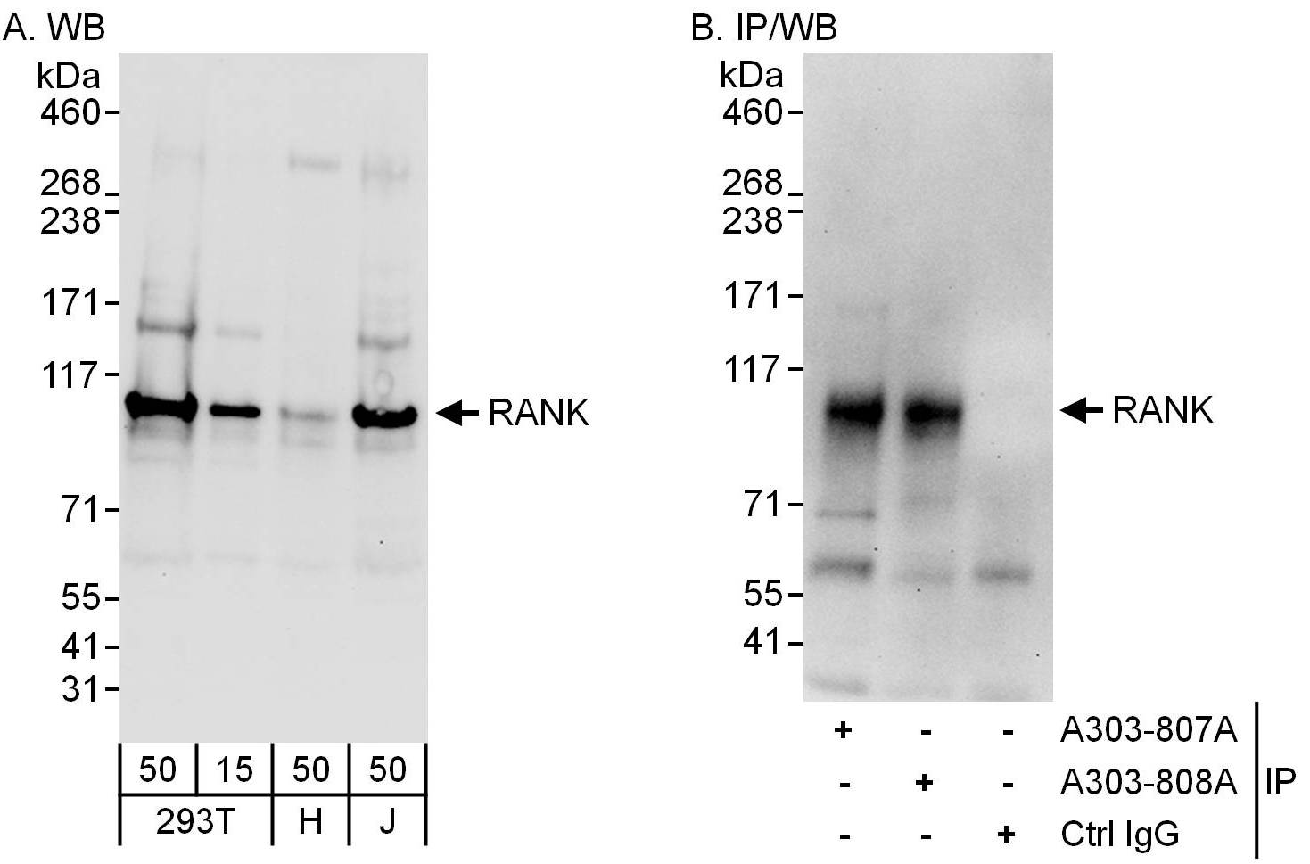 RANK/TNFRSF11A Antibody