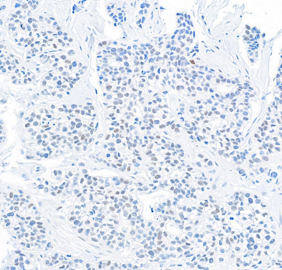 DEC1 Antibody