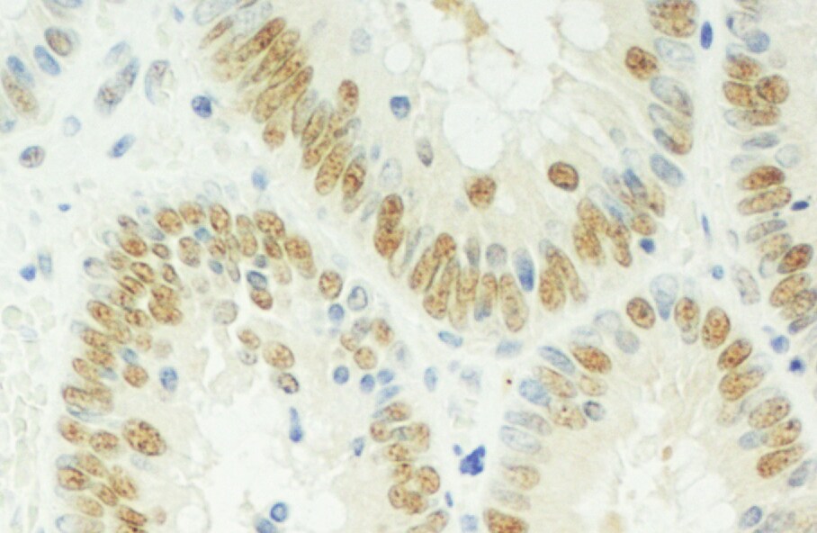 RBM17 Antibody