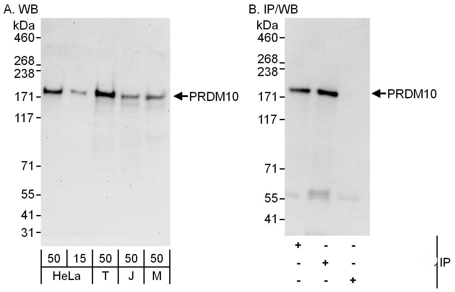 PRDM10 Antibody
