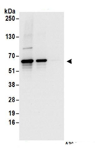 EDC3 Antibody