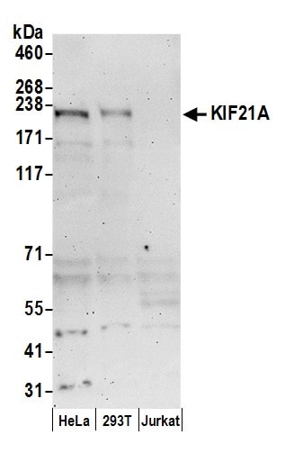 KIF21A Antibody