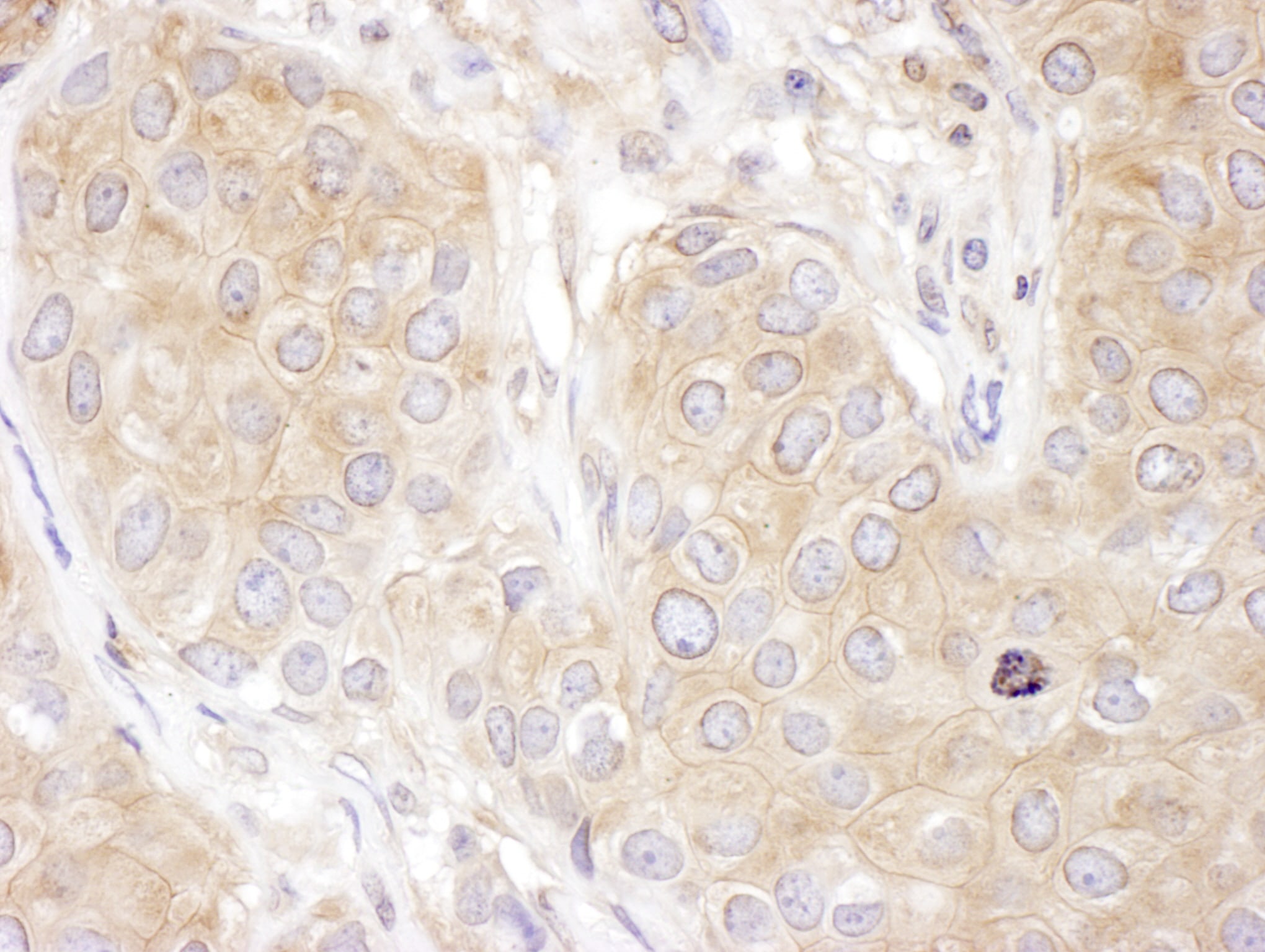 Dynactin Subunit 2/DCTN2/DCTN-50 Antibody