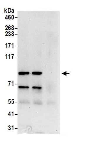 Centaurin beta 2 Antibody