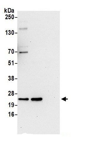 Biliverdin Reductase B/BLVRB Antibody