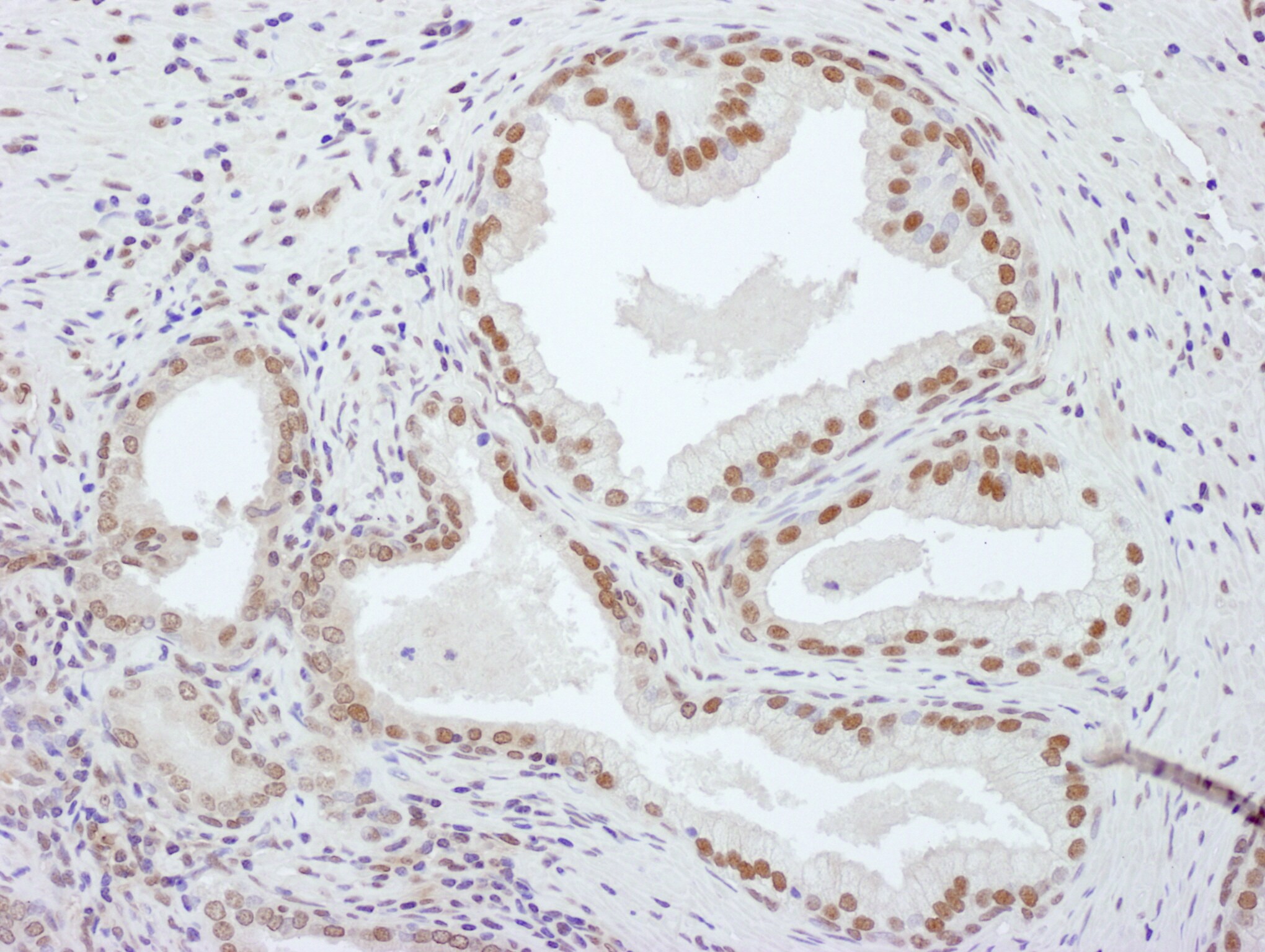 PCYT1A Antibody