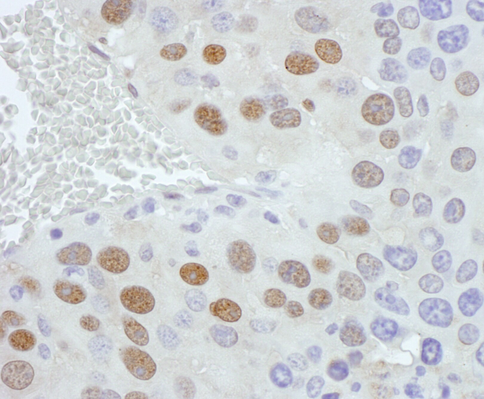PCYT1A Antibody