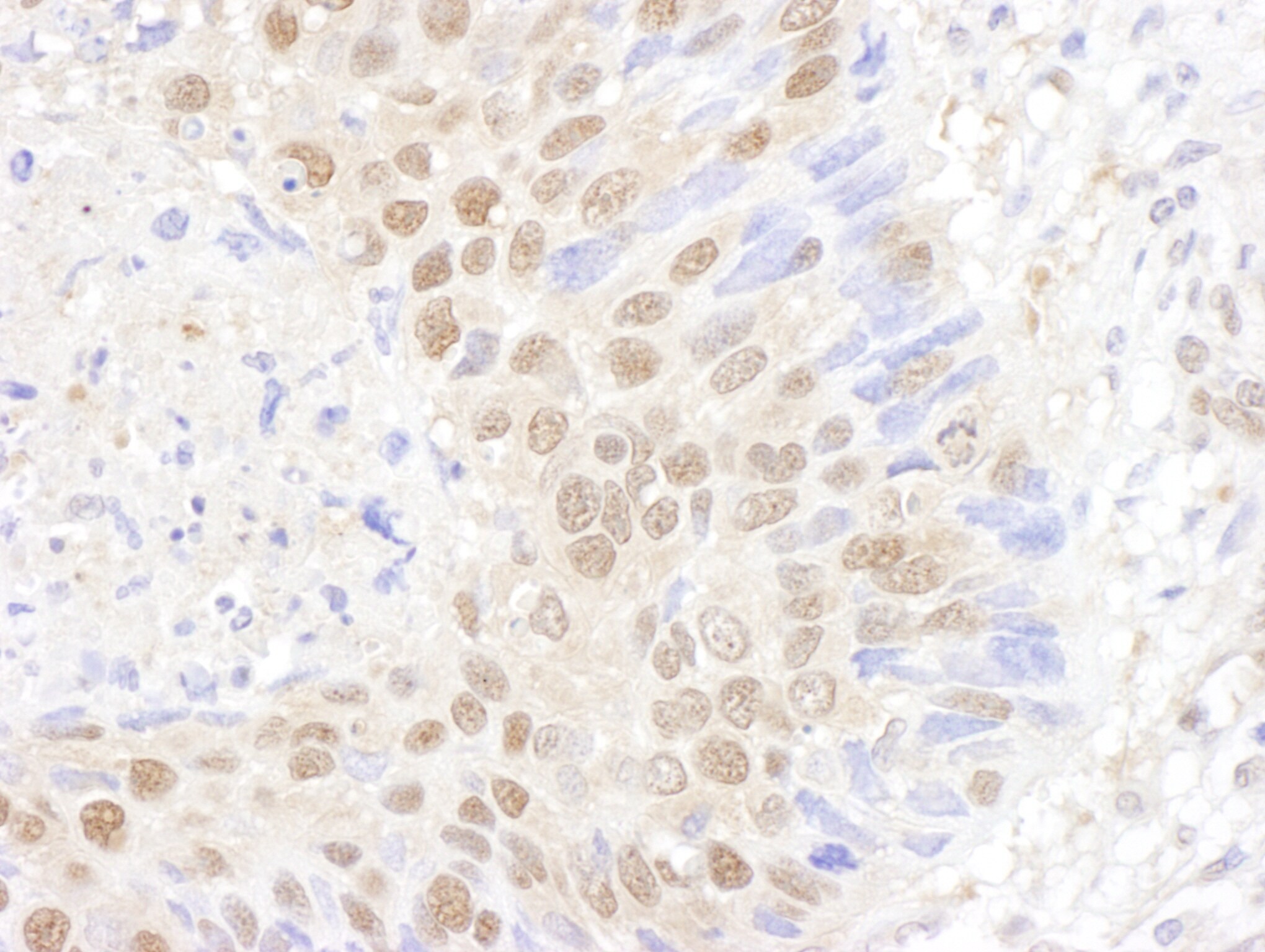 PSMB7 Antibody