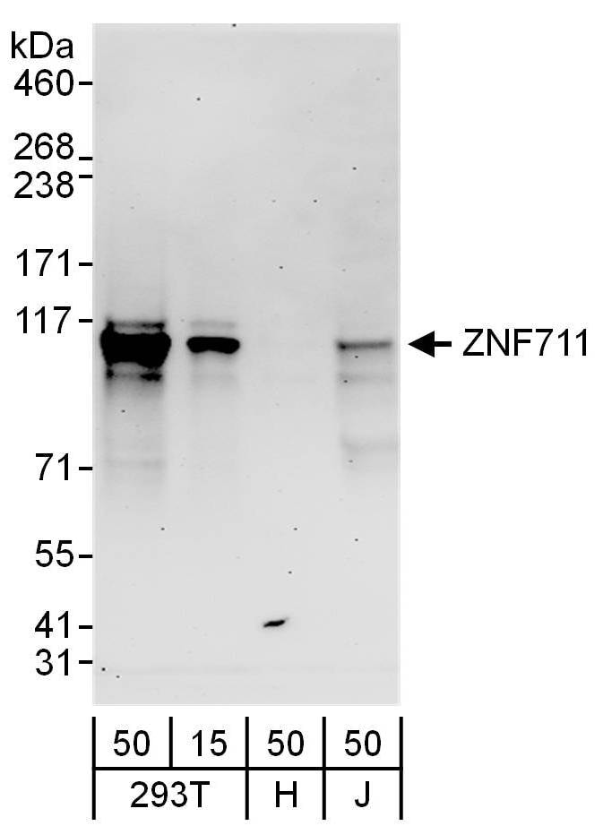 ZNF711 Antibody