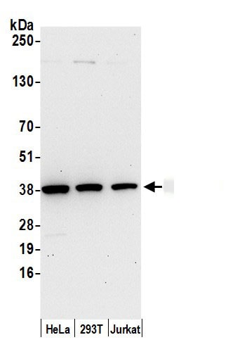 AKR1B1 Antibody