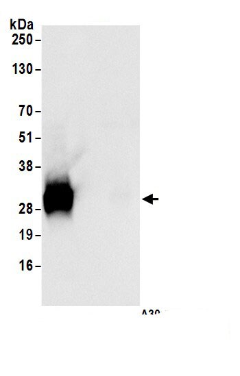 CTHRC1 Antibody