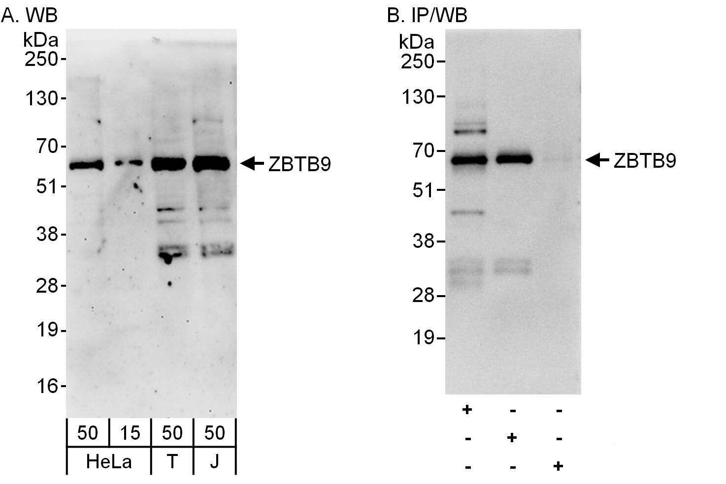 Zinc finger and BTB domain-containing protein 9 Antibody