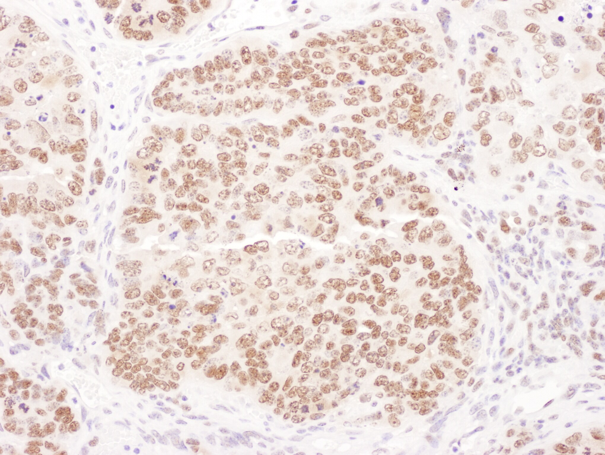 DNA Polymerase delta, catalytic subunit Antibody