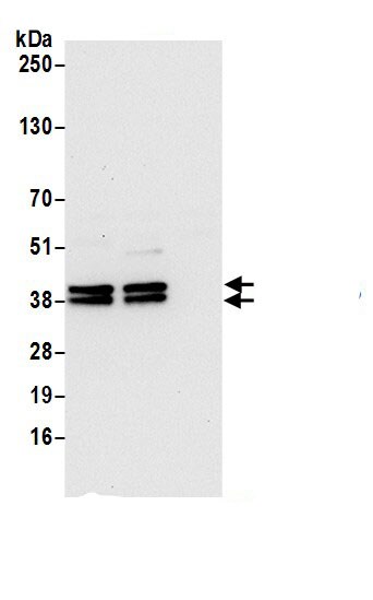 VTA1 Antibody