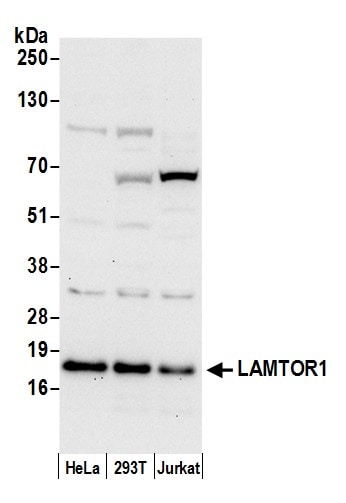 LAMTOR1 Antibody