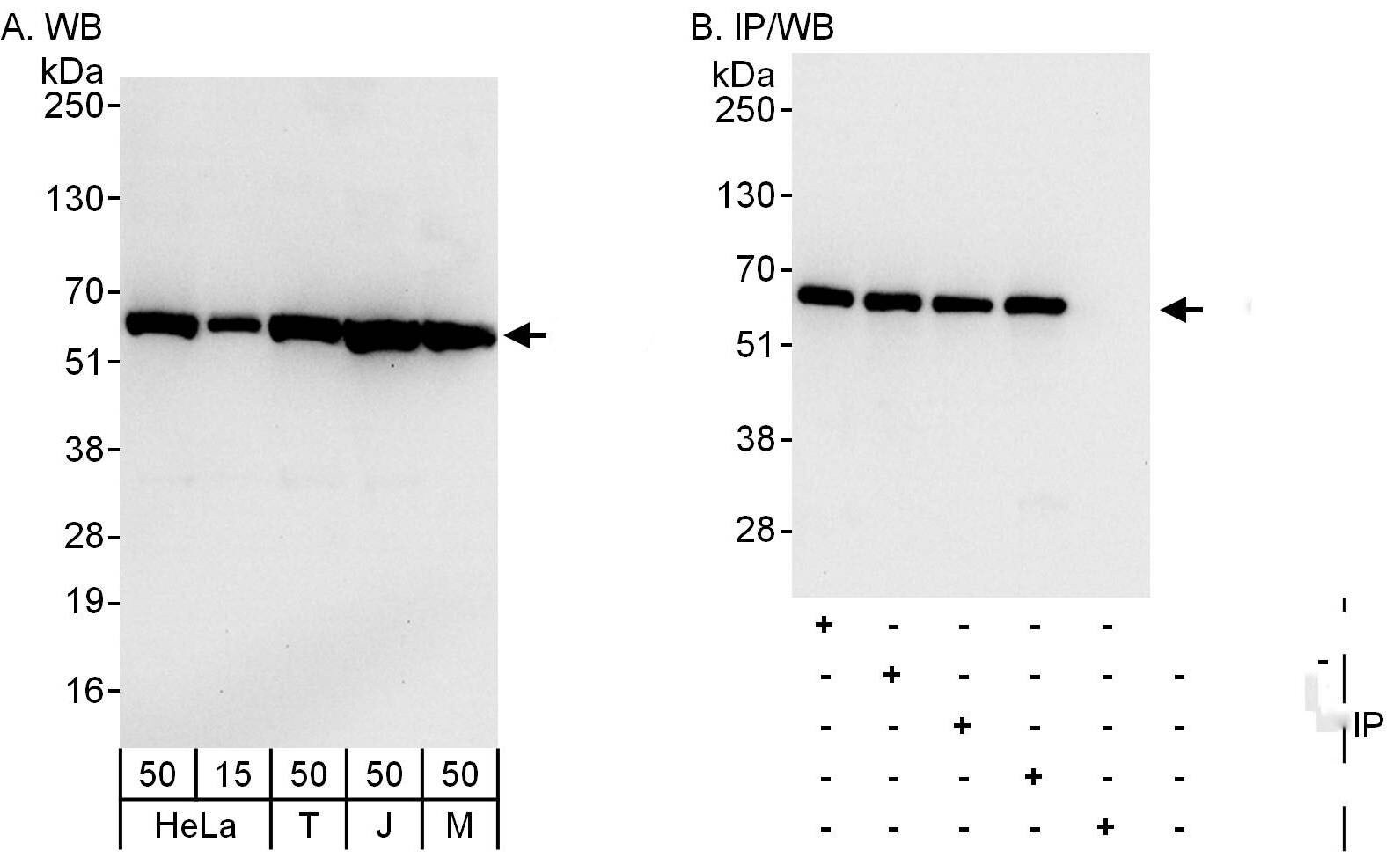 CCT8 Antibody