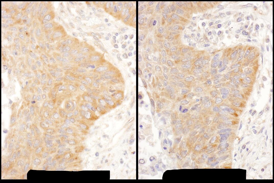 IMP2/IGF2BP2 Antibody