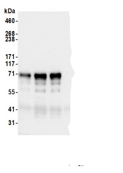 QRICH1 Antibody