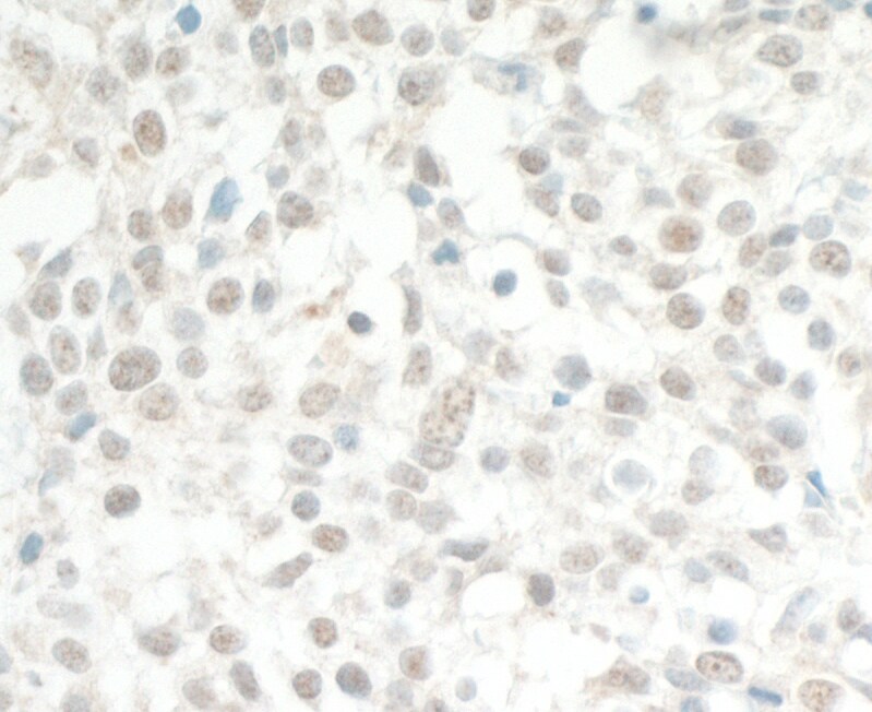 THRAP2 Antibody