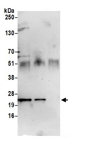 RAB10 Antibody