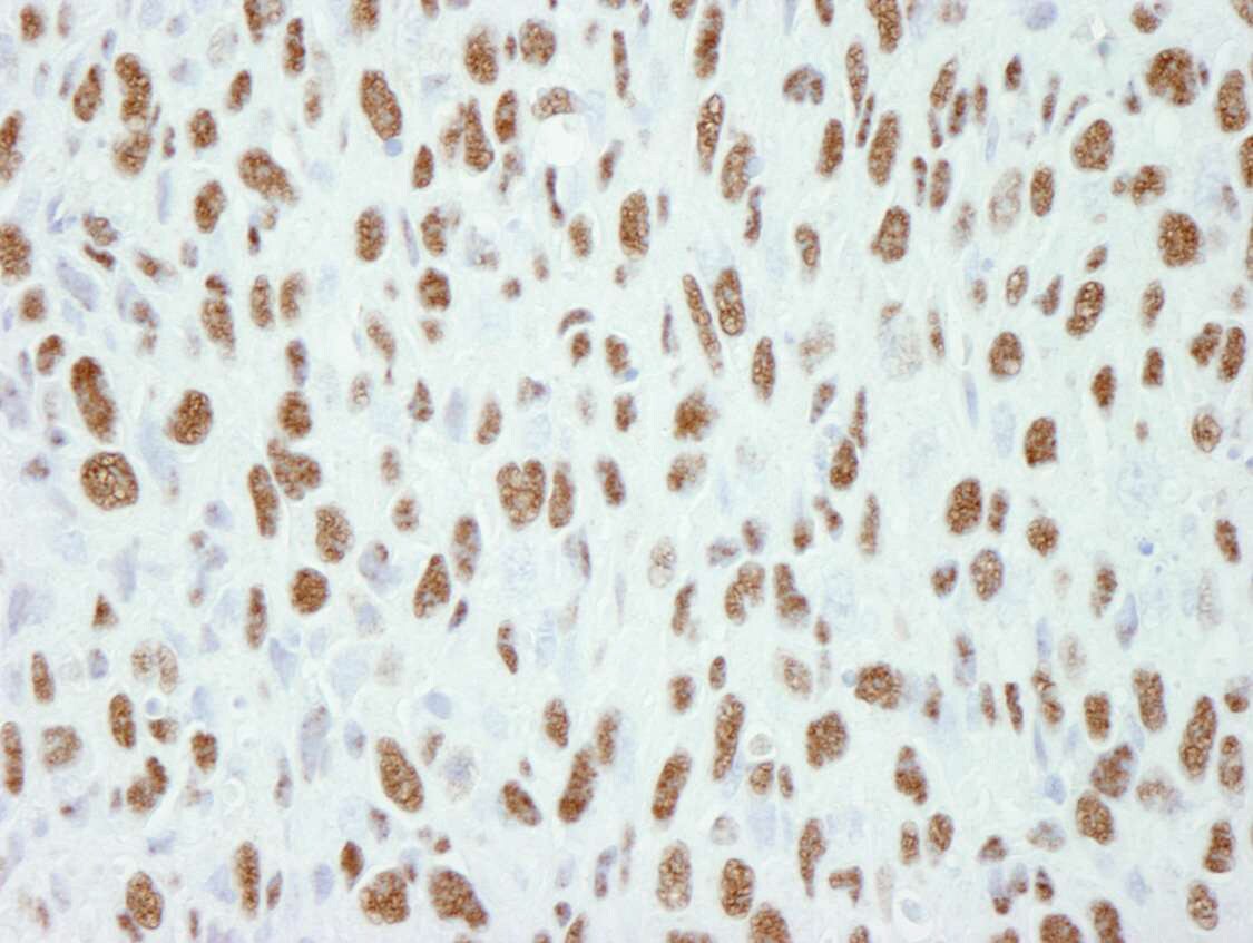 TCERG1 Antibody