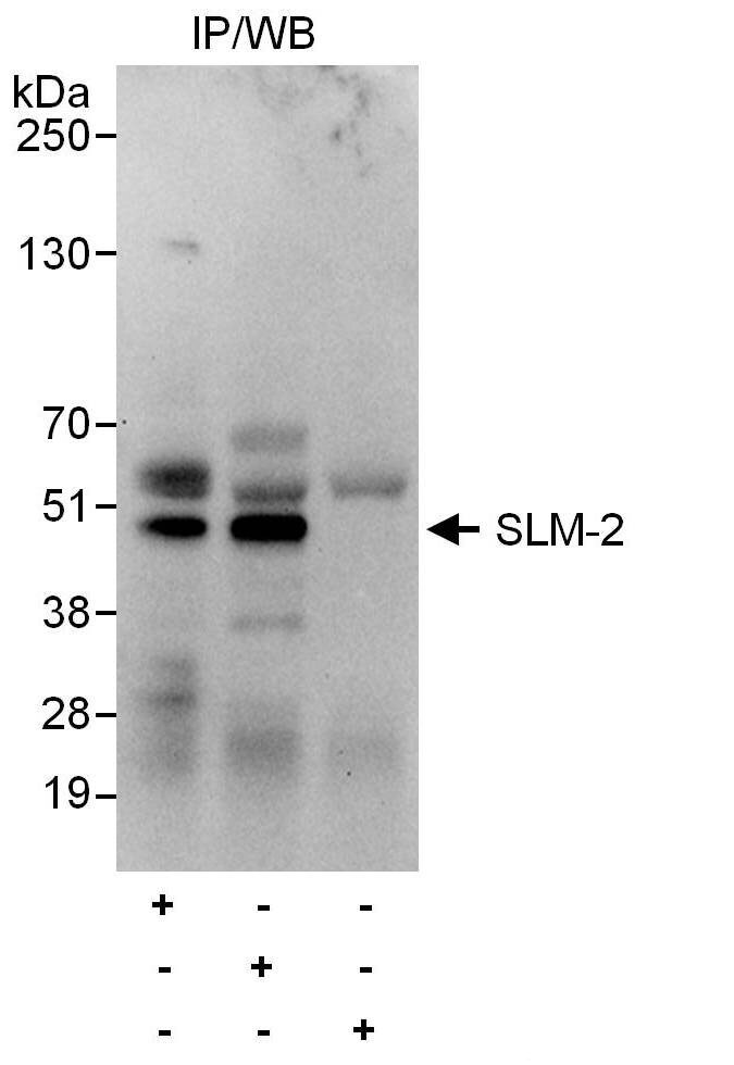 KHDRBS3 Antibody