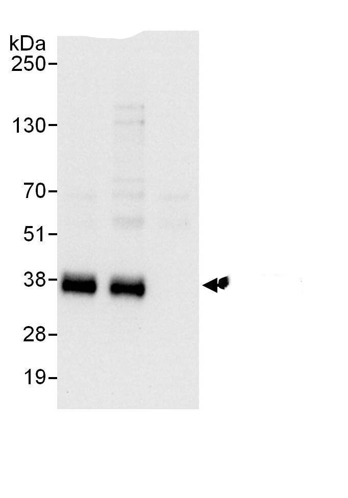TRA2A Antibody