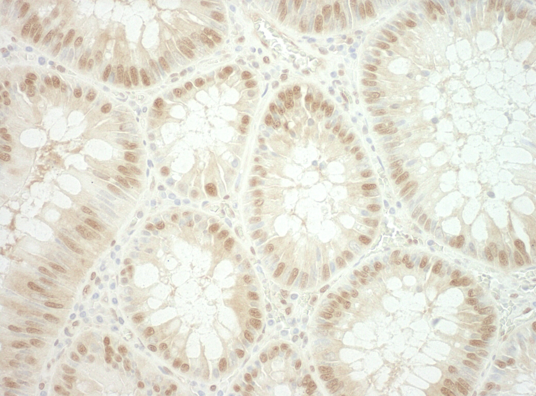 RUVBL2 Antibody